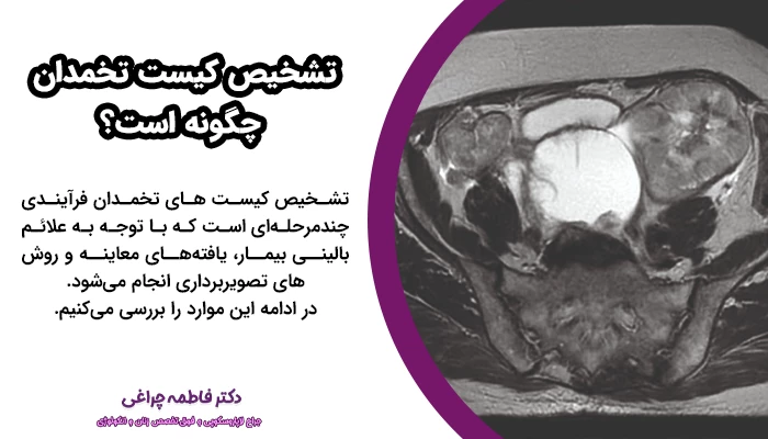 تشخیص کیست تخمدان با معاینه بالینی و پالپ لگنی، سونوگرافی ترانس‌واژینال، آزمایش‌های خون (مثل CA-125)و تصویربرداری پیشرفته ممکن است