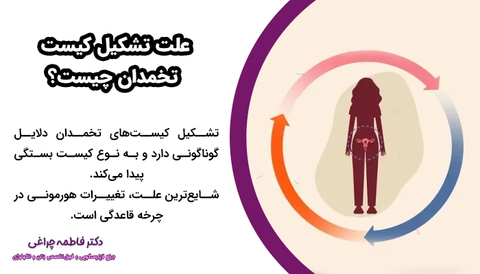 تشکیل کیست‌های تخمدان دلایل مختلفی دارد که این به نوع کیست بستگی پیدا می کند