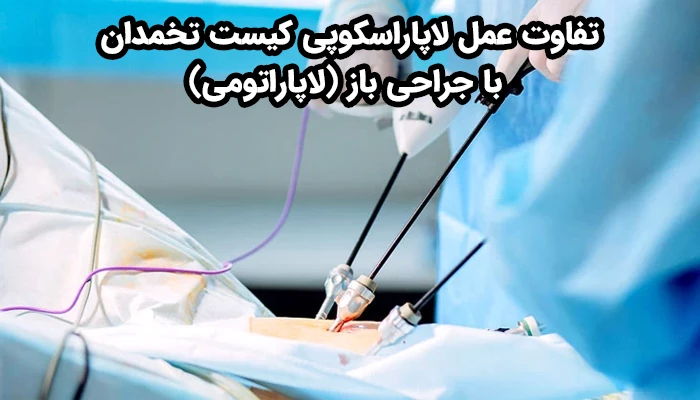 درمان کیست تخمدان با روش لاپاراسکوپی در مقایسه با روش لاپاراتومی تفاوت های بسیار زیادی دارد.