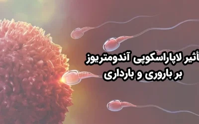 لاپاراسکوپی اندومتریوز: روشی پیشرفته برای درمان ضایعات و مشکلات باروری