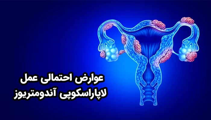 عوارض جراحی لاپاراسکوپی آندومتریوز خفیف و قابل کنترل هستند، اما آگاهی بیمار از آن‌ها می‌تواند به مدیریت بهتر شرایط کمک کند.