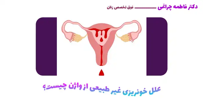 علل خونریزی غیر طبیعی از واژن چیست؟