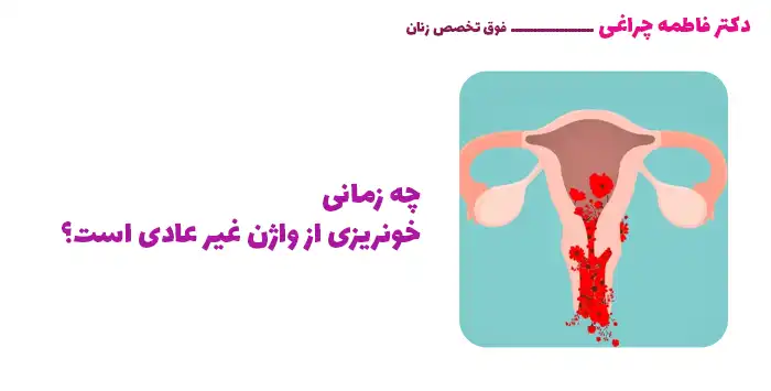 چه زمانی خونریزی از واژن غیر عادی است؟