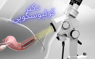 بهترین دکتر برای کولپوسکوپی در تهران 