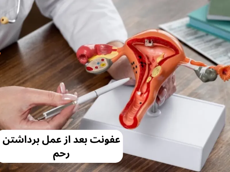 عفونت بعد از عمل برداشتن رحم