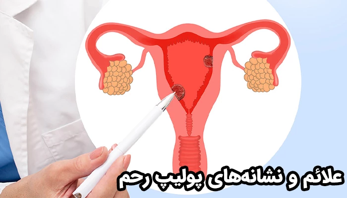 پولیپ همیشه علامت‌دار نیست با این حال ممکن است بسته به اندازه، موقعیت و وضعیت پولیپ، علائم متفاوتی بروز یابد.