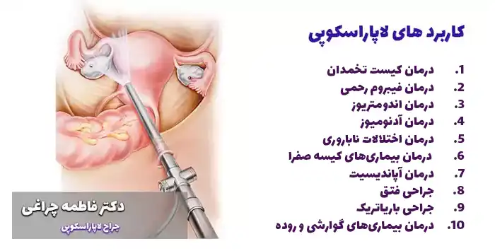 کاربرد لاپاراسکوپی چیست؟