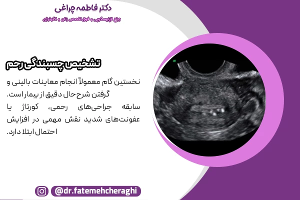 تشخیص چسبندگی رحم با هیستروسکوپی و سونوگرافی انجام میشود