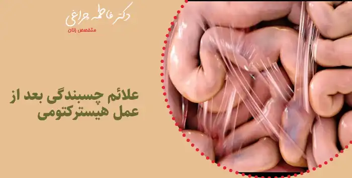 علائم چسبندگی بعد از عمل هیسترکتومی