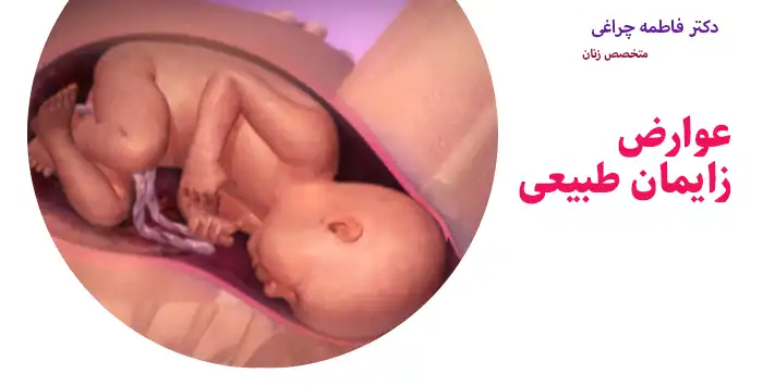 عوارض زایمان طبیعی