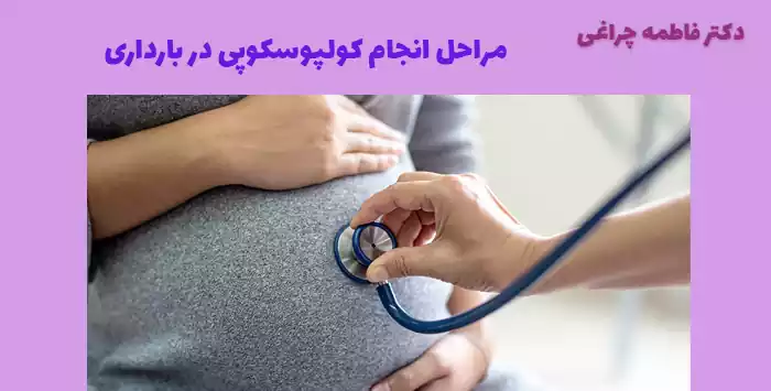 مراحل انجام کولپوسکوپی در بارداری