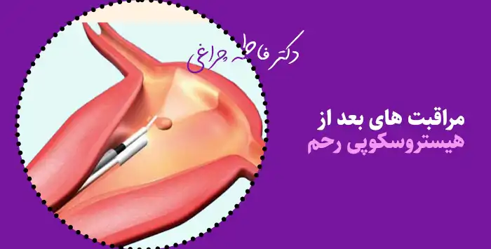 مراقبت های بعد از هیستروسکوپی رحم