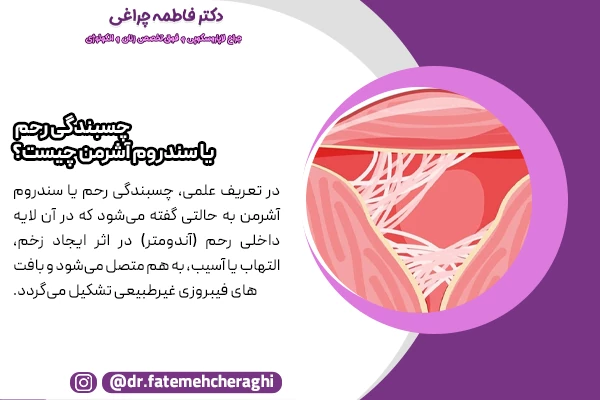 در چسبندگی رحم دیواره های داخلی رحم به یکدیگر میچسبند