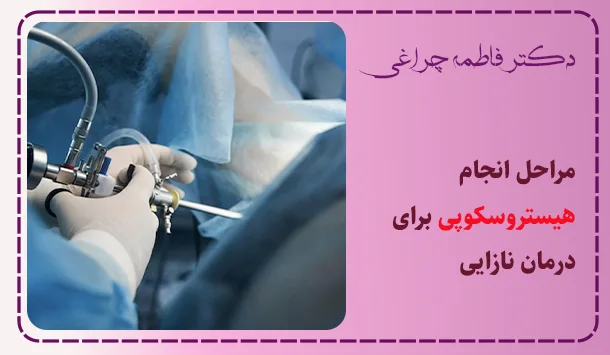 مراحل انجام هیستروسکوپی برای درمان نازایی