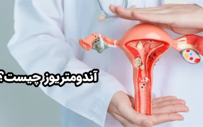 آندومتریوز چیست؟ علل، علائم، تشخیص و درمان اندومتریوز