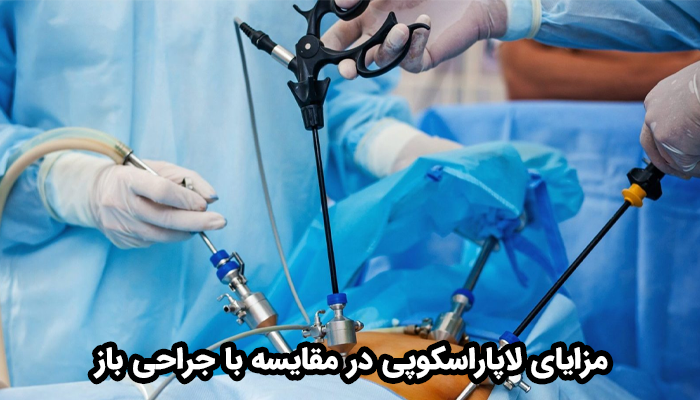 مزایای لاپاراسکوپی در مقایسه با جراحی باز