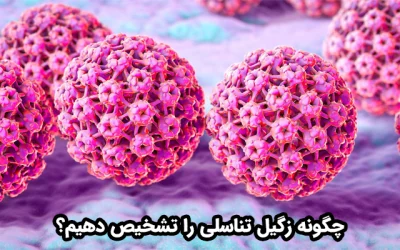 زگیل تناسلی چیست؟ مهم ترین روش های تشخیص زگیل تناسلی