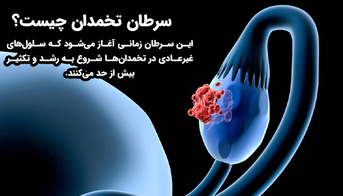 سرطان تخمدان به رشد بیش از حد و نامنظم سلول‌ها در تخمدان‌ها گفته می‌شود.