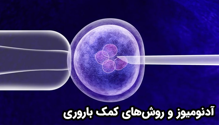 بسیاری از زنان مبتلا با استفاده از IVF، موفق به بارداری شده‌اند.