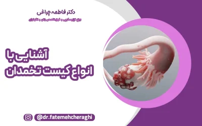 راهنمای جامع انواع کیست تخمدان