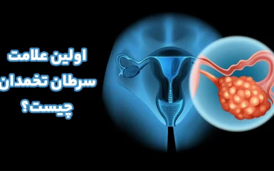 معرفی مهمترین علائم سرطان تخمدان