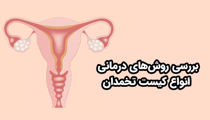 روش‌های مختلفی برای راه درمان کیست تخمدان وجود دارد که بر اساس نوع آن، متفاوت است.