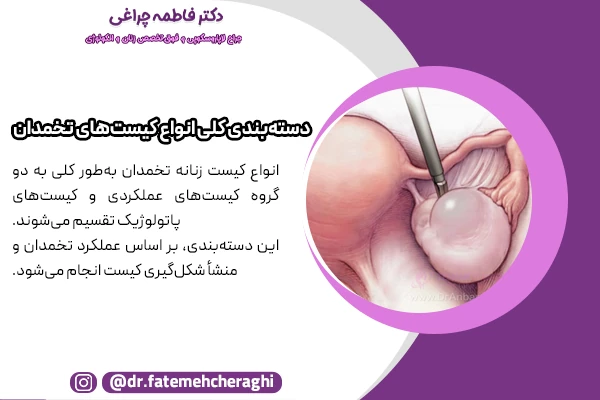 انواع کیست تخمدان شامل کیست های عملکردی و غیرعملکردی است.