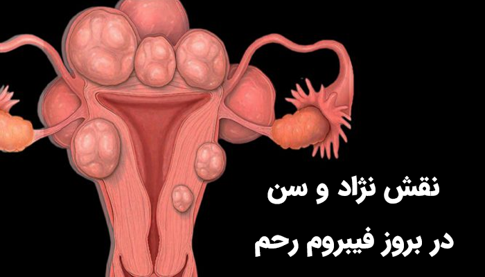 فاکتورهای ژنتیکی، نژادی و سنی همگی به‌صورت مستقیم یا غیرمستقیم در علت فیبروم رحم نقش دارند.