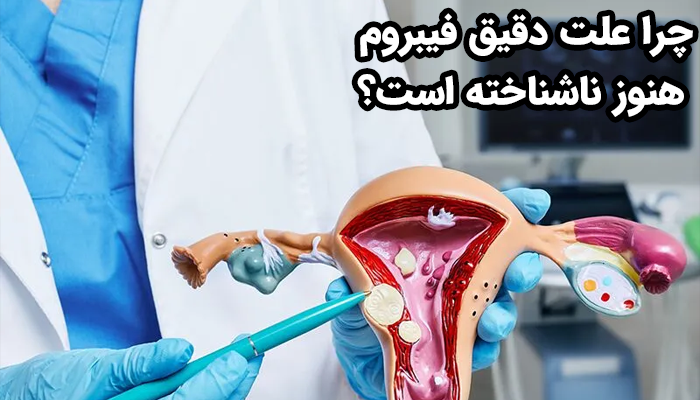دلیل ناشناخته بودن علت دقیق فیبروم رحم، پیچیدگی زیاد در اثرگذاری عوامل ژنتیکی، هورمونی، محیطی و سبک زندگی روی هم در ایجاد فیبروم رحم است.