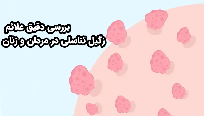 در مردان، زگیل‌ها بیشتر در روی آلت تناسلی، پوست بیضه‌ها، اطراف مقعد یا کشاله ران ظاهر می‌شوند
