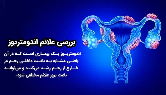 اندومتریوز یک بیماری است که در آن بافتی مشابه به بافت داخلی رحم در خارج از رحم رشد می‌کند و می‌تواند باعث بروز علائم مختلفی شود.