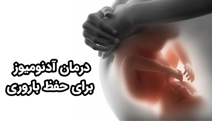 در زنانی که با آدنومیوز رحم مواجه اند و قصد بارداری دارند، انتخاب راههای درمان آدنومیوز حساس‌تر و تخصصی‌تر می‌شود.