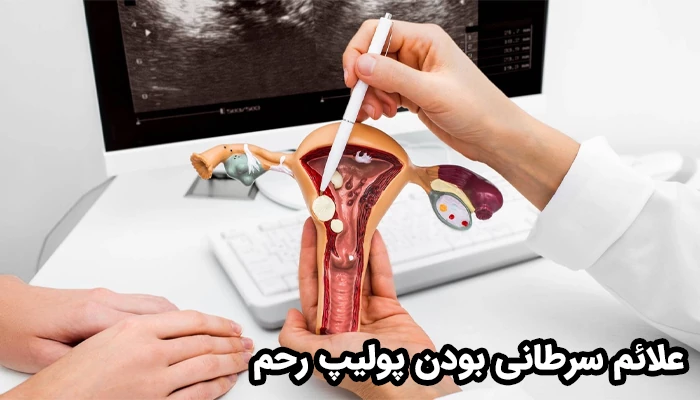 در زنان یائسه، خطر سرطانی شدن پولیپ رحم افزایش می‌یابد.