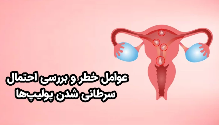 اگرچه بیشتر پولیپ‌های رحم خوش‌خیم هستند، اما برخی عوامل می‌توانند احتمال تبدیل آن‌ها به پولیپ بدخیم را افزایش دهند.