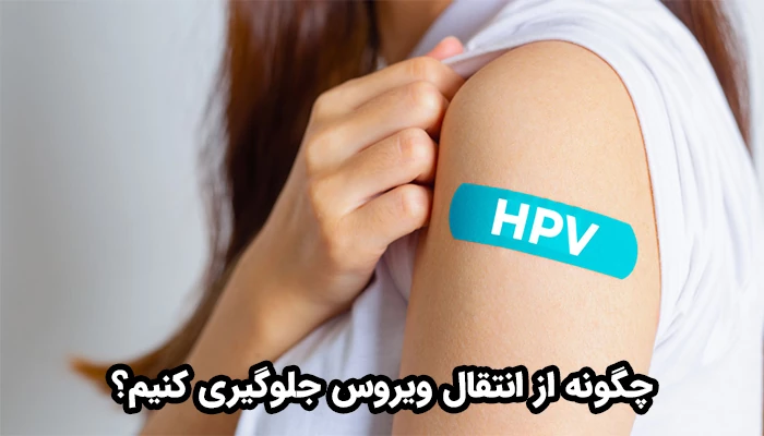 راه های جلوگیری از انتقال زگیل تناسلی باید ترکیبی از اقدامات پیشگیرانه، مراقبت‌های بهداشتی و آموزش جنسی صحیح در نظر گرفته شود.