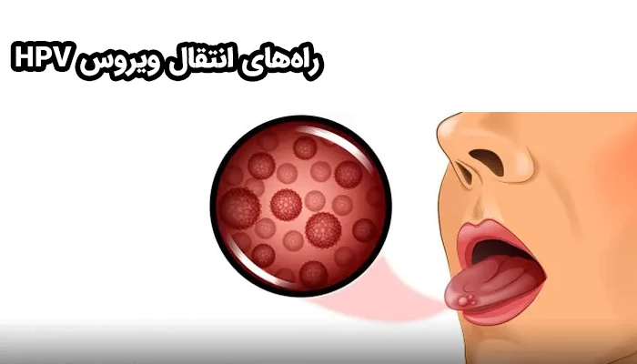 تماس جنسی، تماس پوستی، انتقال از طریق مادر و استفاده از وسایل آلوده مشترک از جمله راه های انتقال ویروس HPV محسوب می‌شود