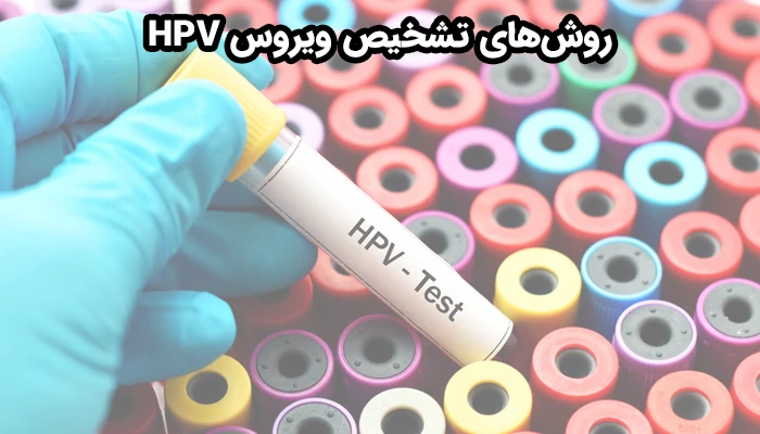 تشخیص ویروس HPV معمولاً بر اساس آزمایش‌های پزشکی و معاینات بالینی انجام می‌شود.