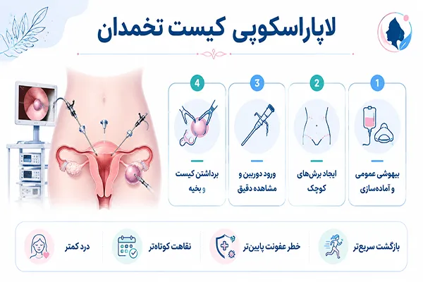 عمل لاپاراسکوپی کیست تخمدان