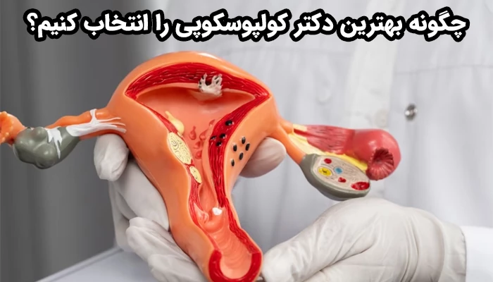 انتخاب بهترین دکتر کولپوسکوپی با در نظر گرفتن تخصص و تجربه، مجوز و صلاحیت، مطالعه نظرات بیماران، امکانات مطب یا بیمارستان، هزینه‌ها، پذیرش و ارتباط موثر و محل مطب ممکن است