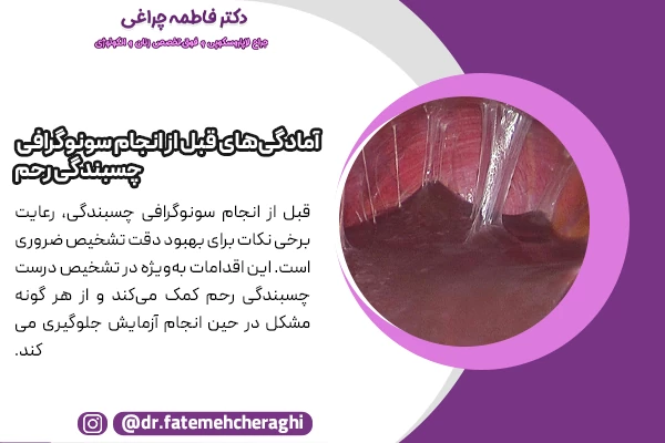 رعایت برخی نکات برای بهبود دقت تشخیص چسبندگی رحم با سونو قبل از انجام سونوگرافی، ضروری است.
