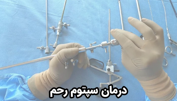 روش اصلی درمان سپتوم رحم هیستروسکوپی کمتهاجمی است