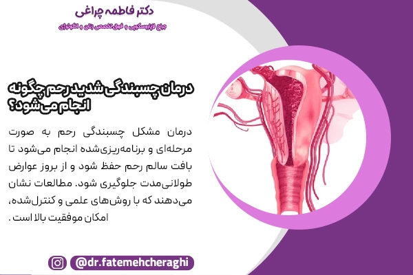 تشخیص دقیق و بررسی پیشرفته رحم، برطرف کردن چسبندگی‌ها با هیستروسکوپی، جلوگیری از تشکیل مجدد چسبندگی‌ها، پیگیری پس از عمل و مراقبت‌های پزشکی و حمایت و آماده‌سازی برای باروری مراحل درمان نوع شدید چسندگی رحم محسوب میشوند