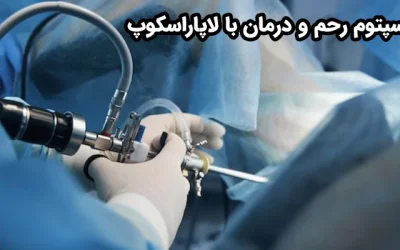 سپتوم رحم و بارداری موفق؛ نقش جراحی لاپاراسکوپی در درمان قطعی