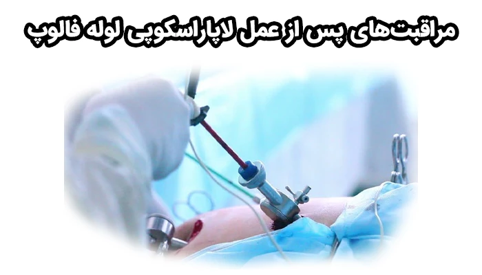 رعایت مراقبت های بعد از عمل لاپاراسکوپی لوله فالوپ به جلوگیری از عوارض و بازگشت سریع‌تر به فعالیت روزمره کمک می‌کند.