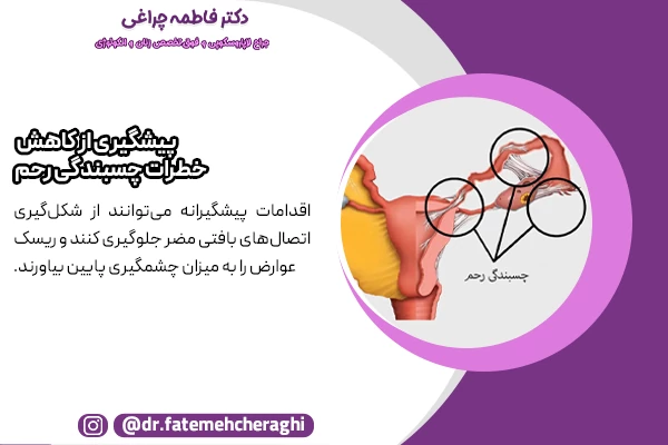 اجرای برخی راهکارهای ساده در محیط های درمانی و خانه باعث می‌شود، احتمال نیاز به درمان‌های پیچیده کاهش یابد و پیشگیری از خطرات فیبروم رحم ممکن گردد