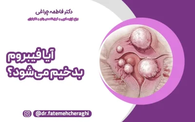 آیا فیبروم بدخیم می‌شود؟ هرآنچه باید درباره فیبروم سرطانی بدانید