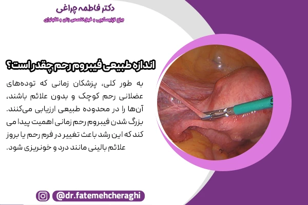 اگر توده‌های عضلانی رحم کوچک و بدون علائم باشند، در محدوده طبیعی ارزیابی در نظر گرفته میشود.
