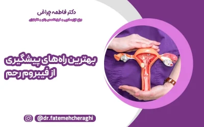 بهترین راه‌های پیشگیری از فیبروم رحم | توصیه‌های متخصصان زنان