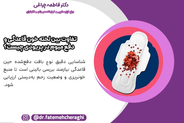 لخته‌های خون معمولا نرم‌تر و تیره‌تر هستند و معمولاً به‌آسانی خرد می‌شوند، در حالی‌که دفع میوم در پریودی ظاهری سفت‌تر و منظم‌تر دارد.