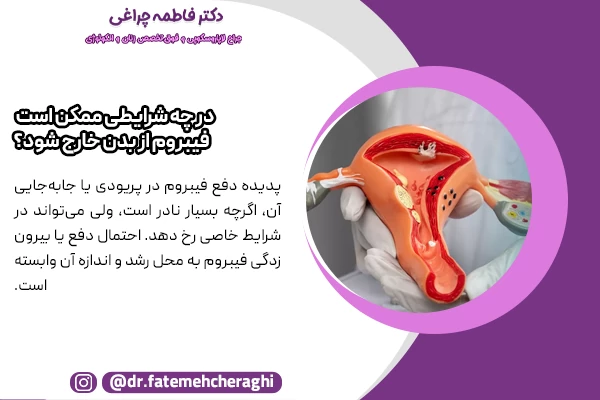 اندازه بزرگ‌ فیبروم خطر تحلیل یا نکروز را افزایش داده و در نتیجه منجر به دفع شدن فیبروم در پریودی می‌شود